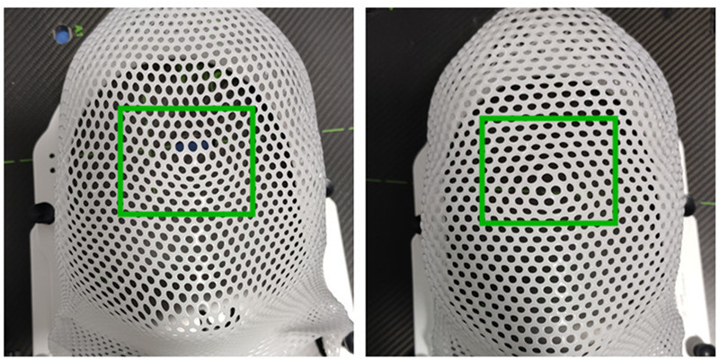 instruction of making radiotherapy mask.jpg