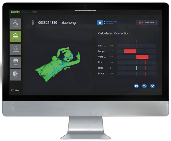 SGRT system for patient treatment.png